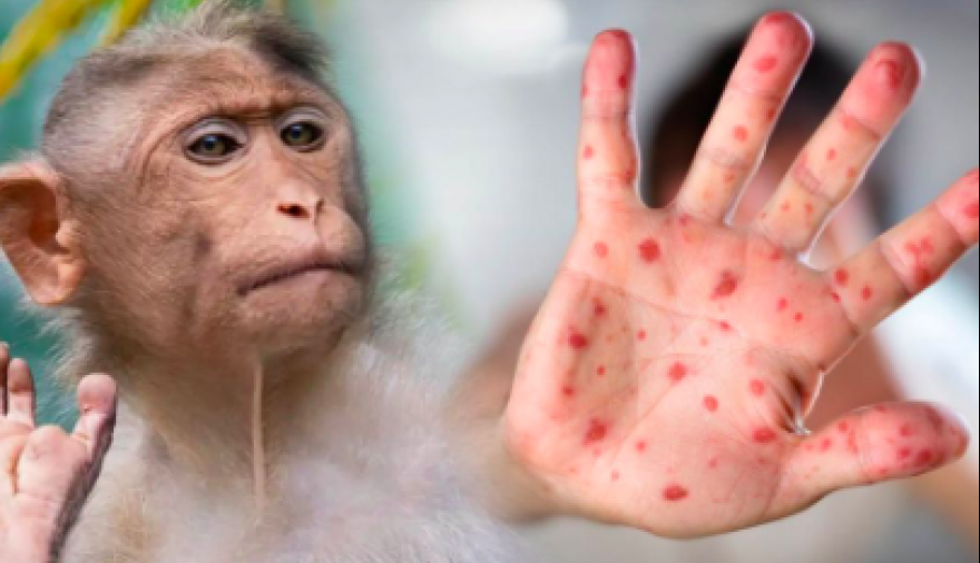 20240816094555_captura-de-pantalla-2024-08-16-a-la-s-09-44-17